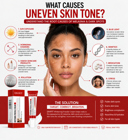 Mooyam Melasma, Freckles and Dark spot Removal Cream