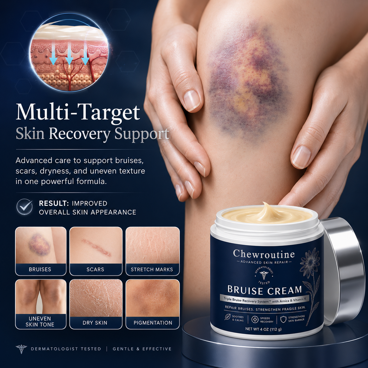 Bruise Repair & Skin-Strengthening Cream