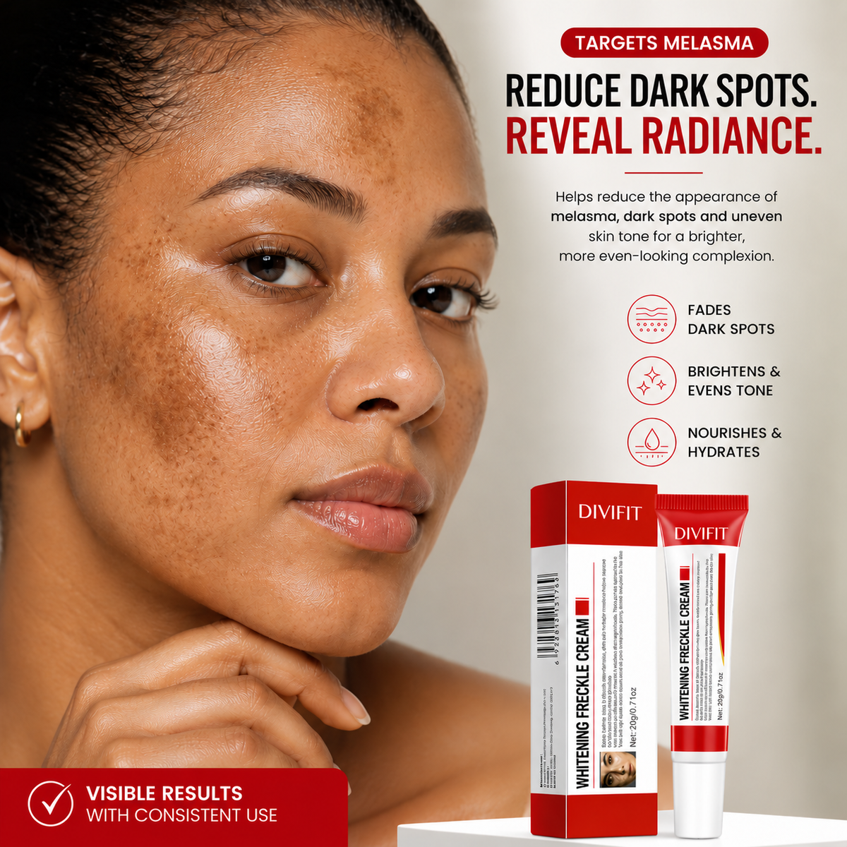 Mooyam Melasma, Freckles and Dark spot Removal Cream