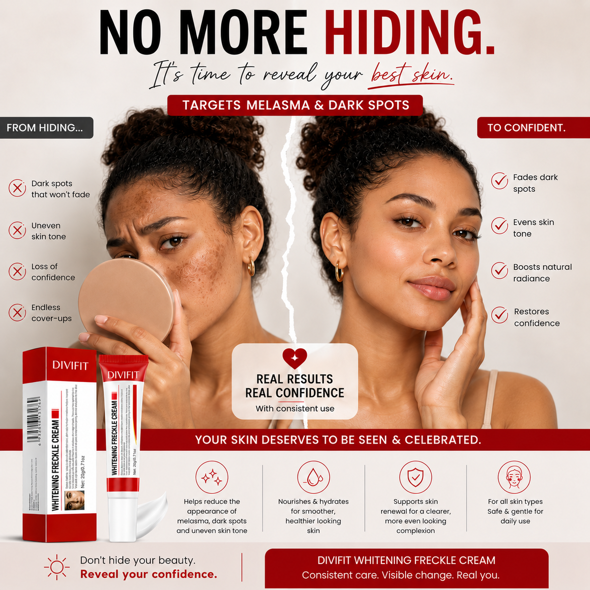 Mooyam Melasma, Freckles and Dark spot Removal Cream