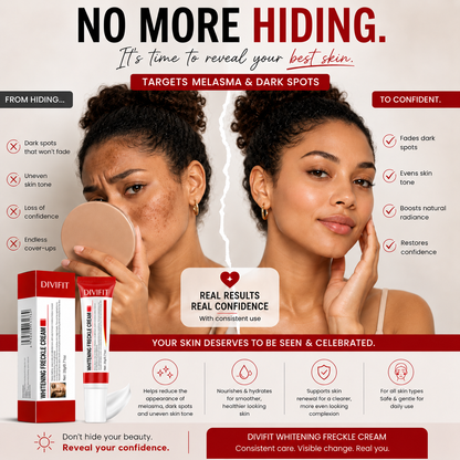 Mooyam Melasma, Freckles and Dark spot Removal Cream