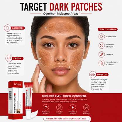 Mooyam Melasma, Freckles and Dark spot Removal Cream